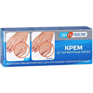 До и после крем для кожи 50мл п/пигментных пятен