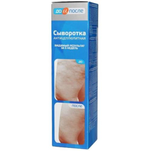 До и после сыворотка а/целлюлит. 130мл. /твинс тэк/